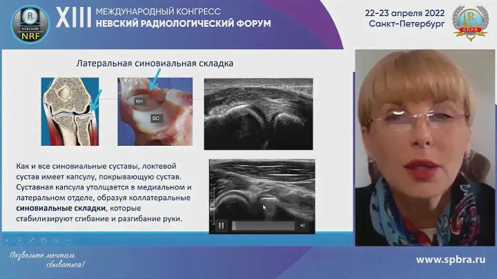 АКТУАЛЬНЫЕ ВОПРОСЫ УЛЬТРАЗВУКОВОГО ИССЛЕДОВАНИЯ ОПОРНО-ДВИГАТЕЛЬНОГО АППАРАТА